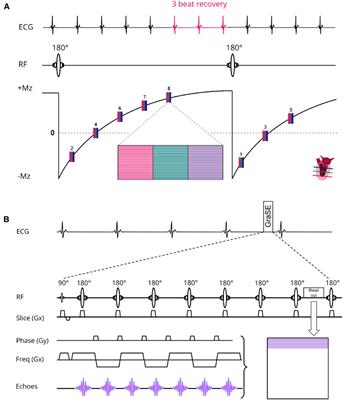 A 3-slice cardiac quantitative native and post-contrast T1 and T2 MRI protocol requiring only four BHs using a 72-channel receive array coil